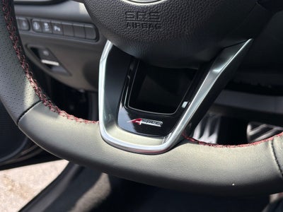 2025 Acura TLX A-Spec Package SH-AWD