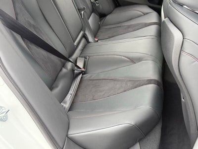 2025 Acura TLX A-Spec Package SH-AWD